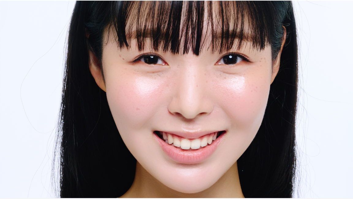 Why Do Juvelook Skin Nodules Occur? Summary of Prevention Points